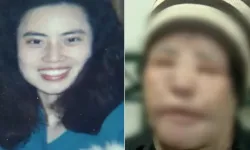 Doktorlar ameliyatı reddetti, yüzüne yemeklik yağ enjekte etti: Güzelleşmek isterken hayatı kabusa döndü