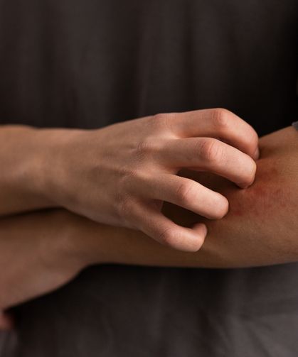 Vücudumuzda Kaşıntı Neden Olur? Kaşıntıya Ne İyi Gelir? Kaşıntılara Karşı Evde Pratik Çözümler