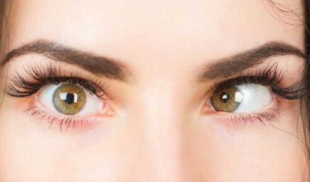 Gözde Şaşılık Neden Oluşur, Hangi Yaşta Başlar ve Tedavisi Mümkün mü?