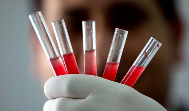 Altın Kan Grubu (Rh Null) Nedir, Neden Bu Kadar Nadir ve Değerli Olarak Görülüyor?