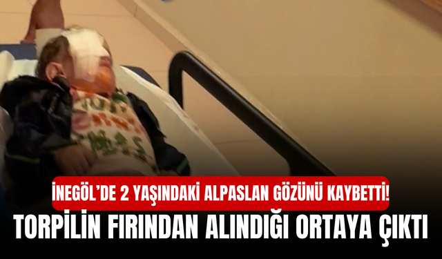 İnegöl’de 2 Yaşındaki Alpaslan Gözünü Kaybetti! Torpilin Fırından Alındığı Ortaya Çıktı