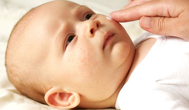 Kış Aylarında Bebeklerin Cildi Neden Daha Hassas Oluyor? İşte Evde Uygulanabilecek 7 Etkili Bakım Önerisi