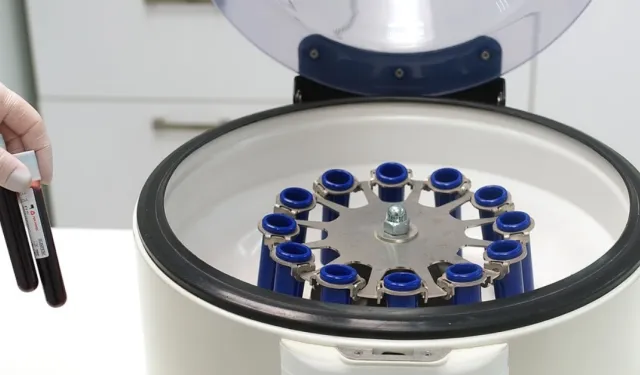 Santrifüj Nedir? Santrifüj Cihazı Ne İşe Yarar, Nerelerde Kullanılır?