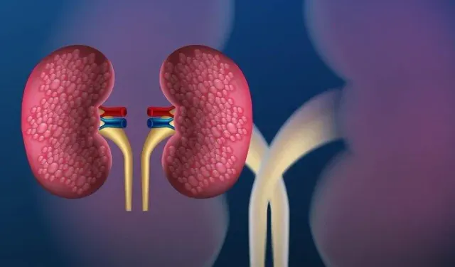 Böbrek Büyümesi Nedir? Neden Olur, Hangi Belirtilerle Ortaya Çıkar?