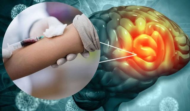 Kan Ver, Sonucu Öğren! Beyin Tümörünü Erken Yakalayan Yeni Test Umut Verdi