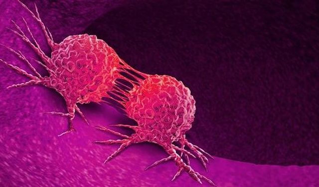 Kanser Riskini Azaltmak Mümkün Mü? Uzmanlara Göre Günlük Hayatta Yapılabilecek 10 Önemli Alışkanlık!