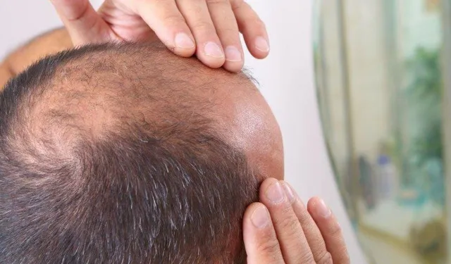 Saç Ekimi Tarih mi Oluyor? Bilim İnsanları Laboratuvarda Gerçek Saç Kökü Üretmeyi Başardı