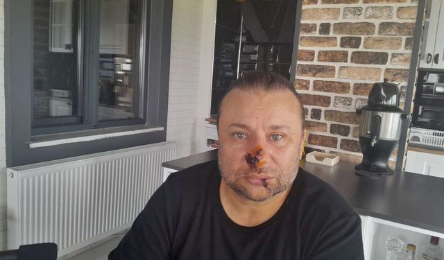 Onur Akay Pitbull Saldırısı Sonrası Entübe Edildi