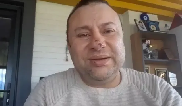 Onur Akay Pitbull saldırısıyla başına gelenleri anlattı! Et yiyen bakteri ile savaşıyor!