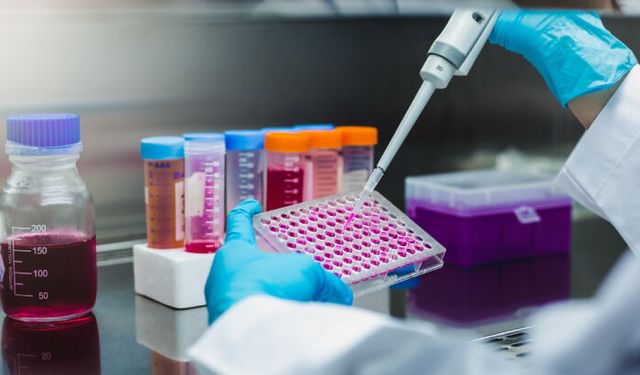 ELISA Testi Nedir? Neden Yapılır, Hangi Hastalıkları Gösterir?
