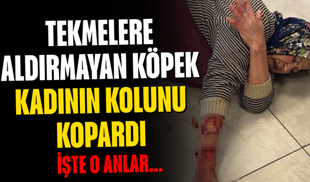Tekmelere aldırmayan köpek kadının kolunu kopardı