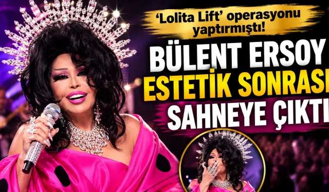 'Lolita Lift' operasyonu yaptırmıştı! Bülent Ersoy estetik sonrası sahneye çıktı