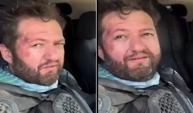 Fenomen Ömer Başdoğan (Nalet Bebe) motosiklet kazası geçirdi