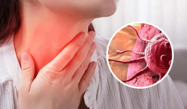 Lenf Kanseri Nedir? Belirtileri, Risk Faktörleri, Teşhis ve Tedavi Yöntemleri