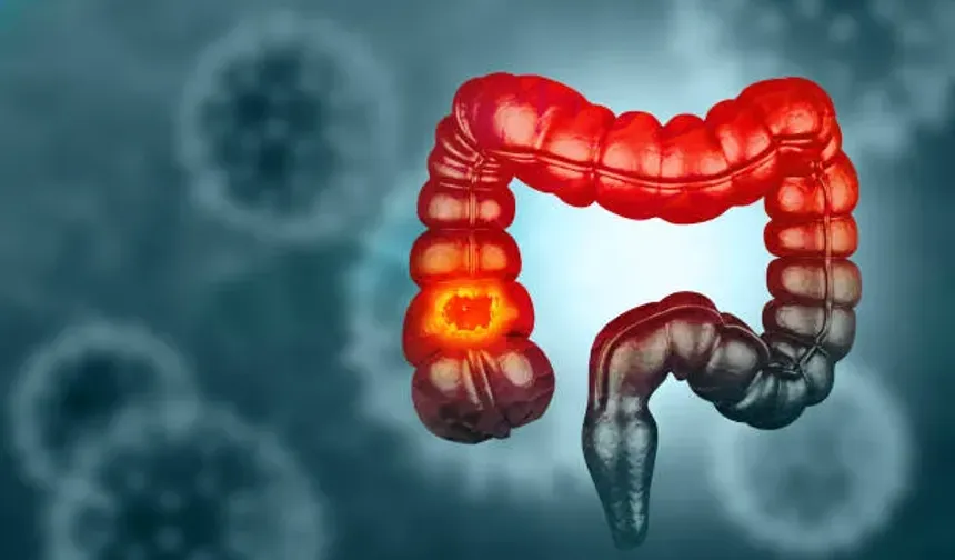 Tıpta Çok Nadir Görülen Vaka! Dünyadaki 60 Vakanın 10’u Türkiye’de Tespit Edildi
