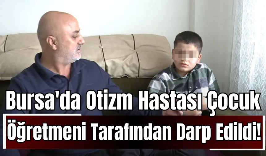 Bursa'da Otizm Hastası Çocuk, Öğretmeni Tarafından Darp Edildi!