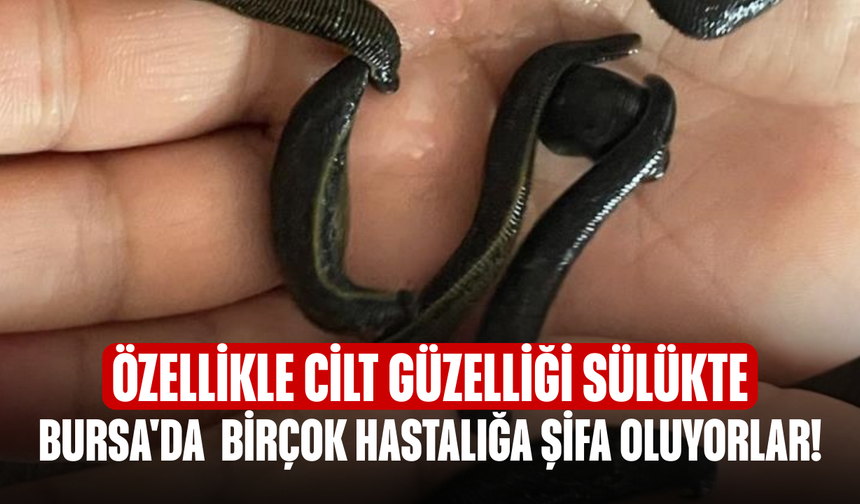 Bursa'da  birçok hastalığa şifa oluyorlar! Özellikle cilt güzelliği sülükte...