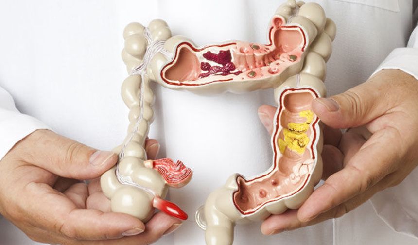 Kolon Kanseri Riski Neden Artıyor? Hangi Alışkanlıklar Tehlike Oluşturuyor ve Erken Teşhis Hayat Kurtarabilir mi?