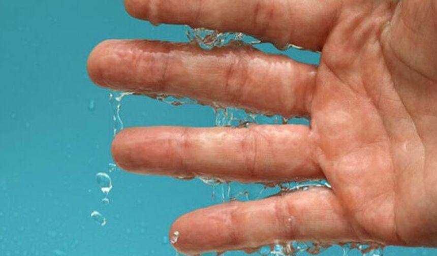 Avuç İçi Terlemesi Hangi Hastalığın İşareti Olabilir?