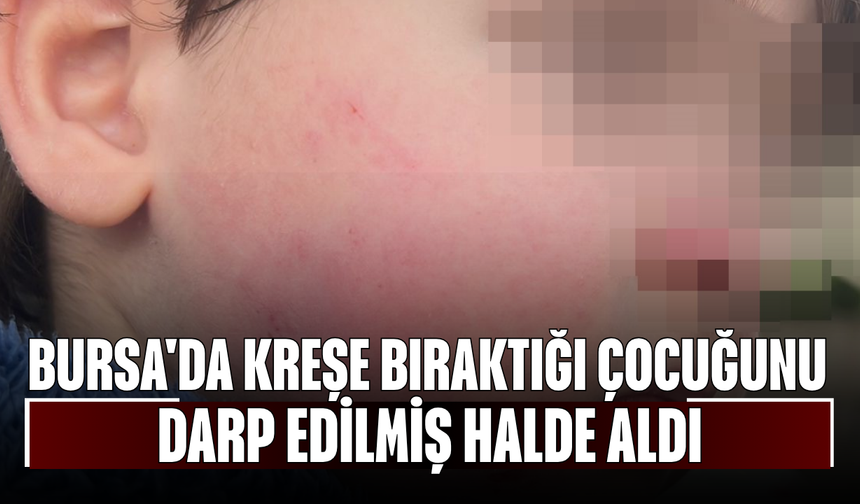 Bursa'da kreşe bıraktığı çocuğunu darp edilmiş halde aldı