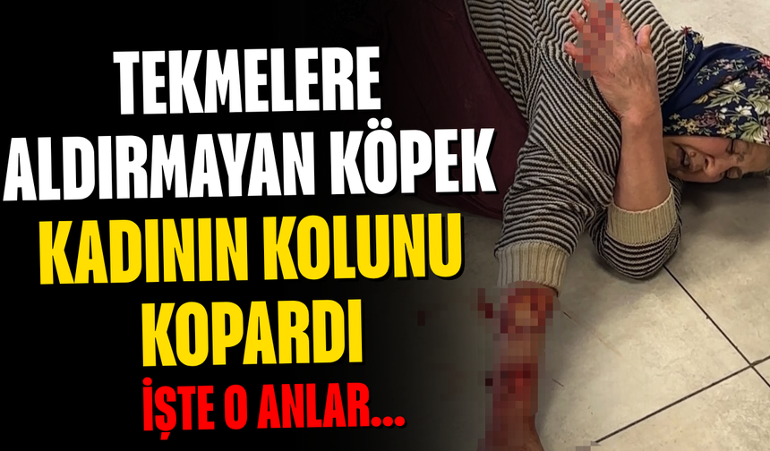 Tekmelere aldırmayan köpek kadının kolunu kopardı