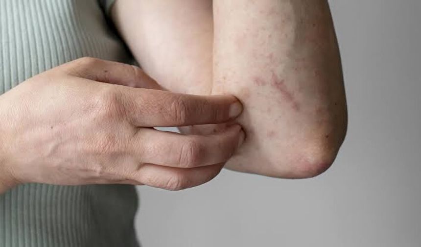 Kuduzda İlk 15 Dakikaya Dikkat! Isırık Ve Tırmalama Sonrası Bu Hata Hayati Risk Taşıyor