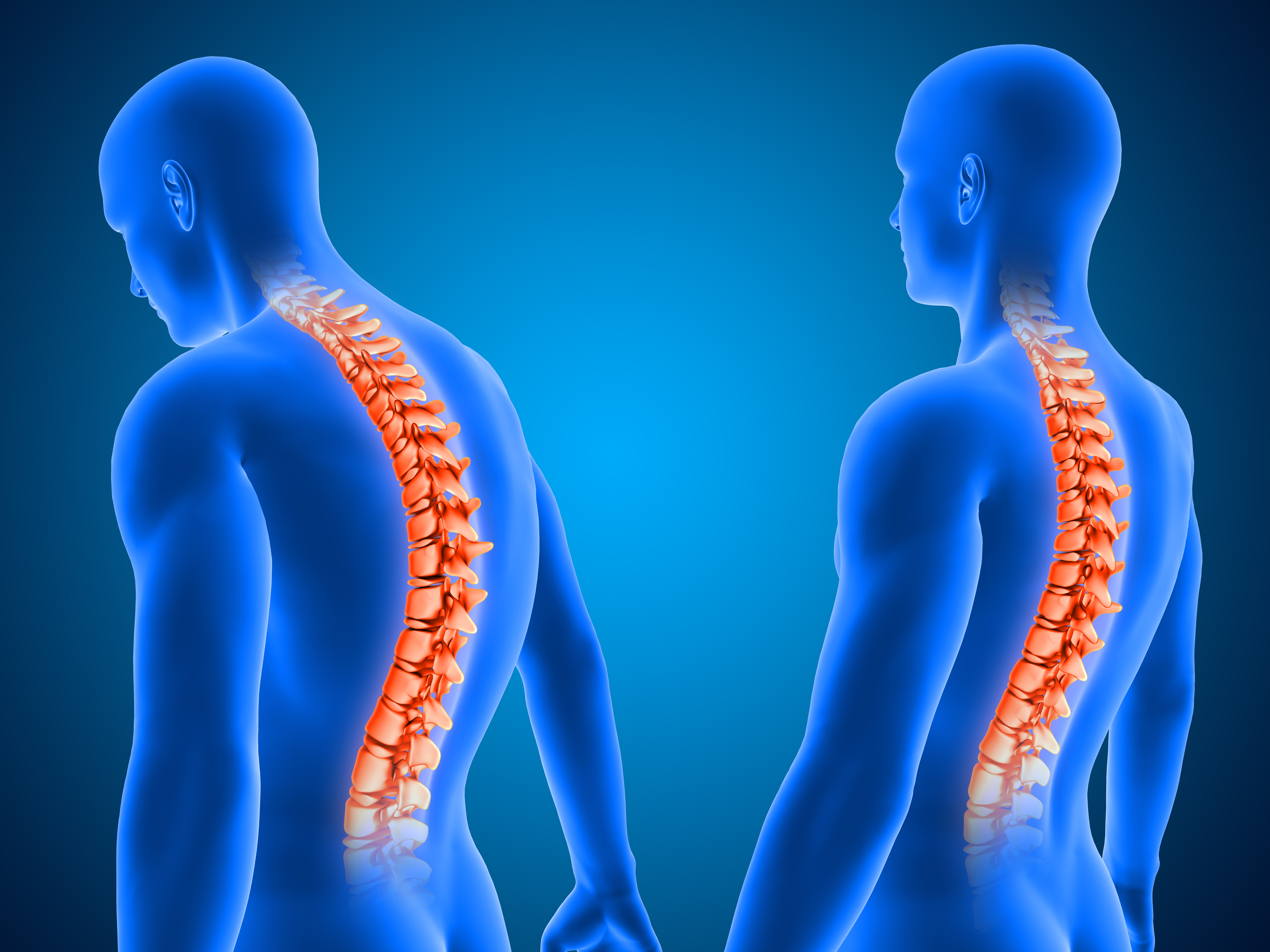 3d-render-showing-correct-poor-posture-with-spine-highlighted