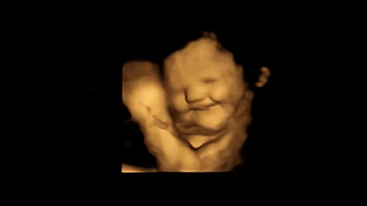 bebek embriyo  (2)