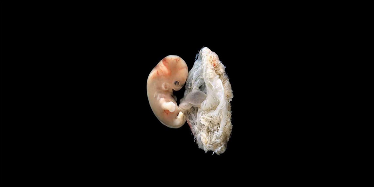 bebek kemik embriyo (15)