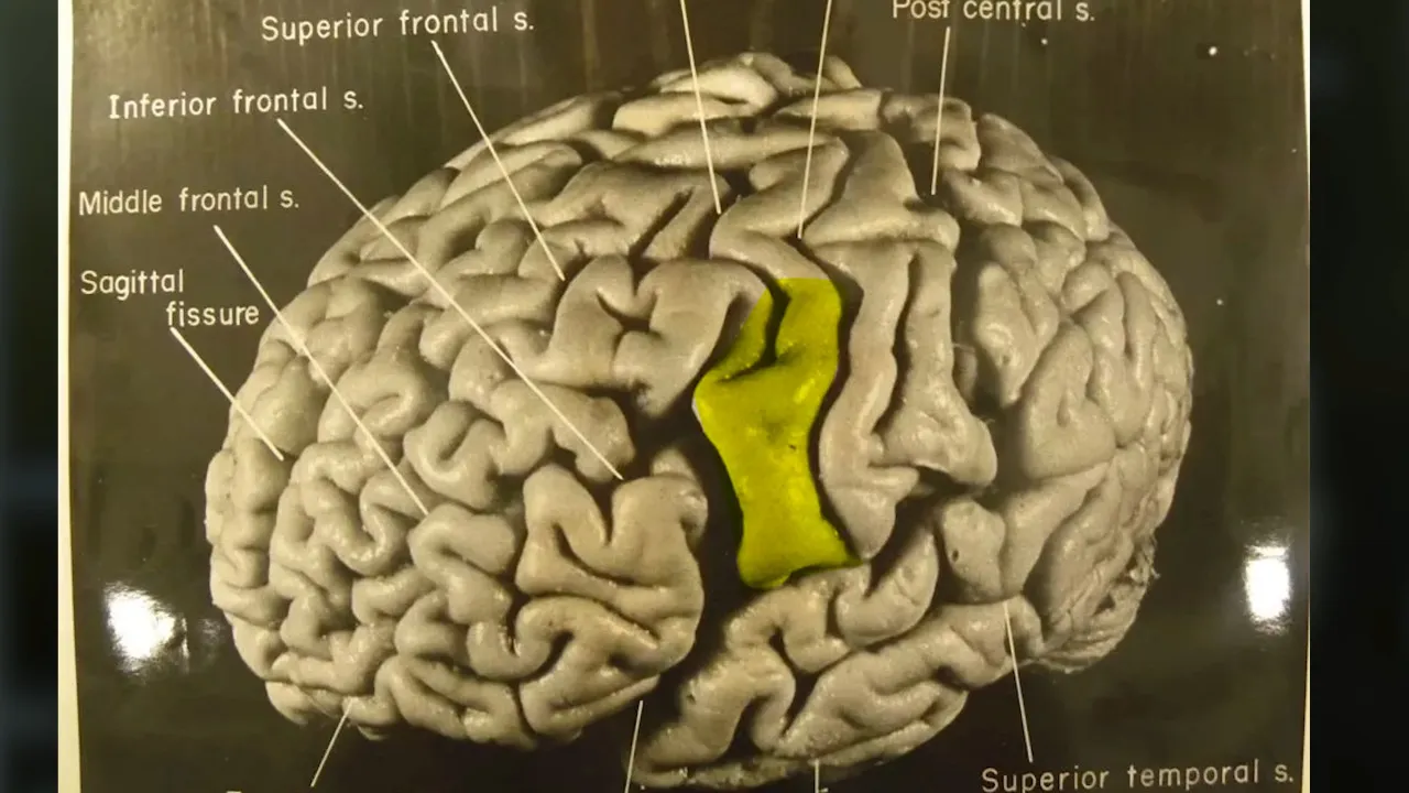 Genc Gazete Einstein'ın Beyni Beyin Bilim (14)