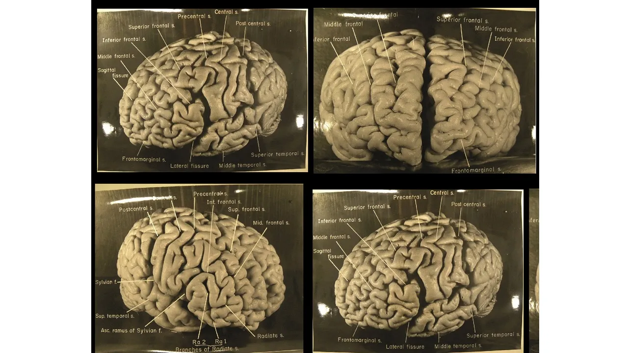 Genc Gazete Einstein'ın Beyni Beyin Bilim (15)
