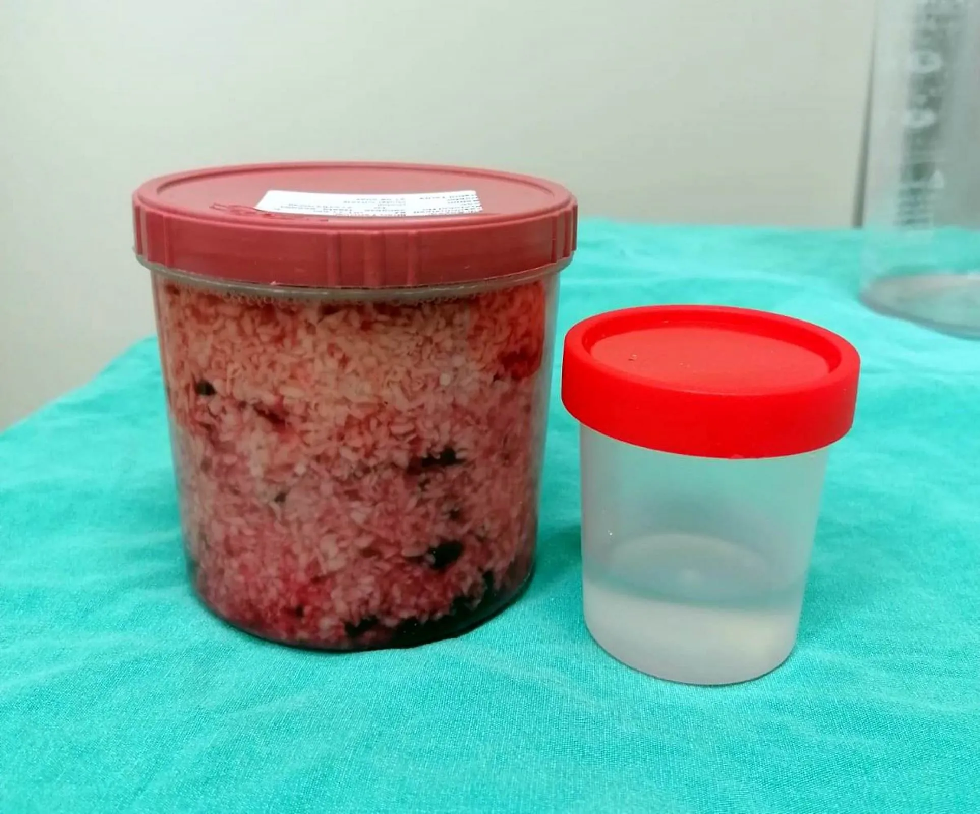 Genc Gazete Prostat Saglik Doktor (6) 1 11Zon