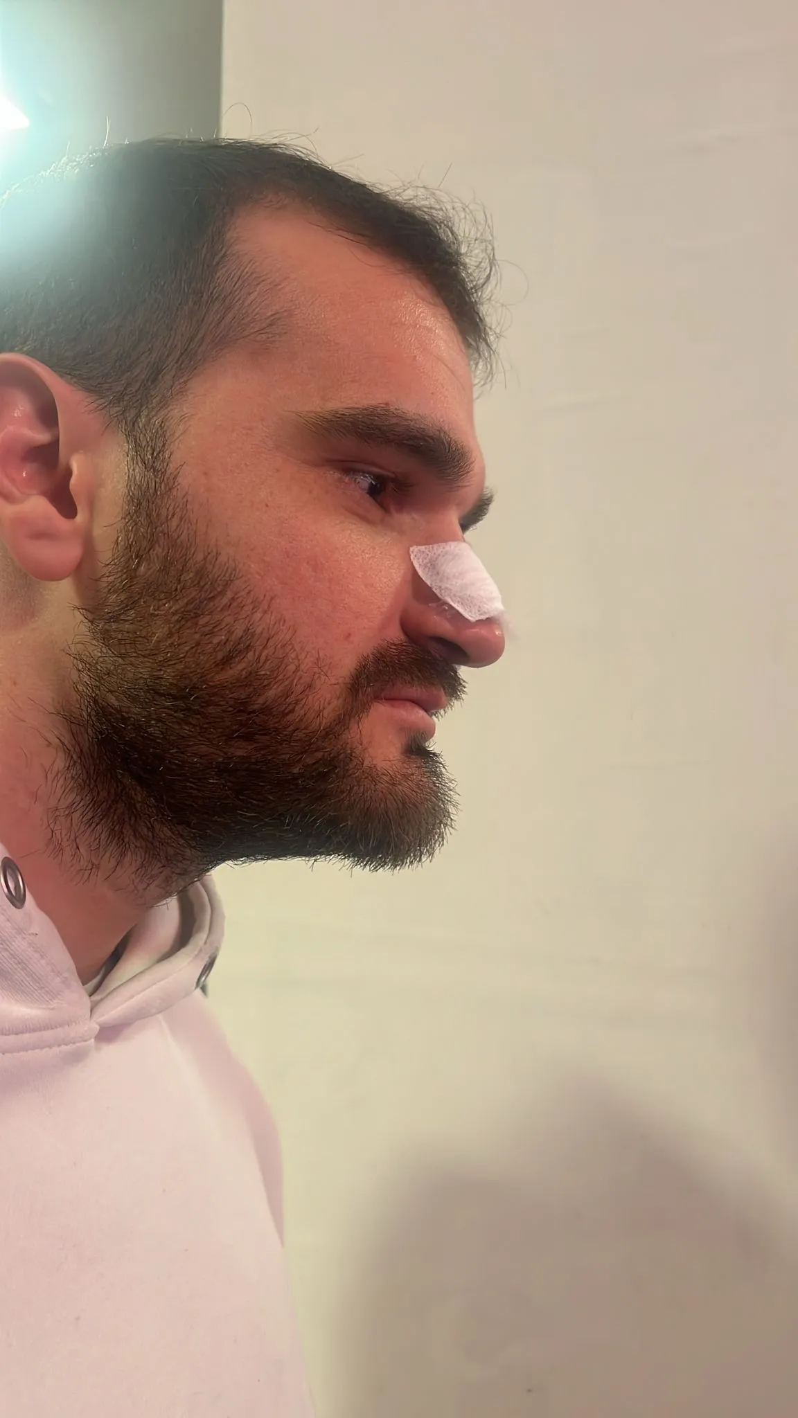 Bursa'da Maç Sonrası Ortalık Karıştı 2 Futbolcu Yaralı! (1)