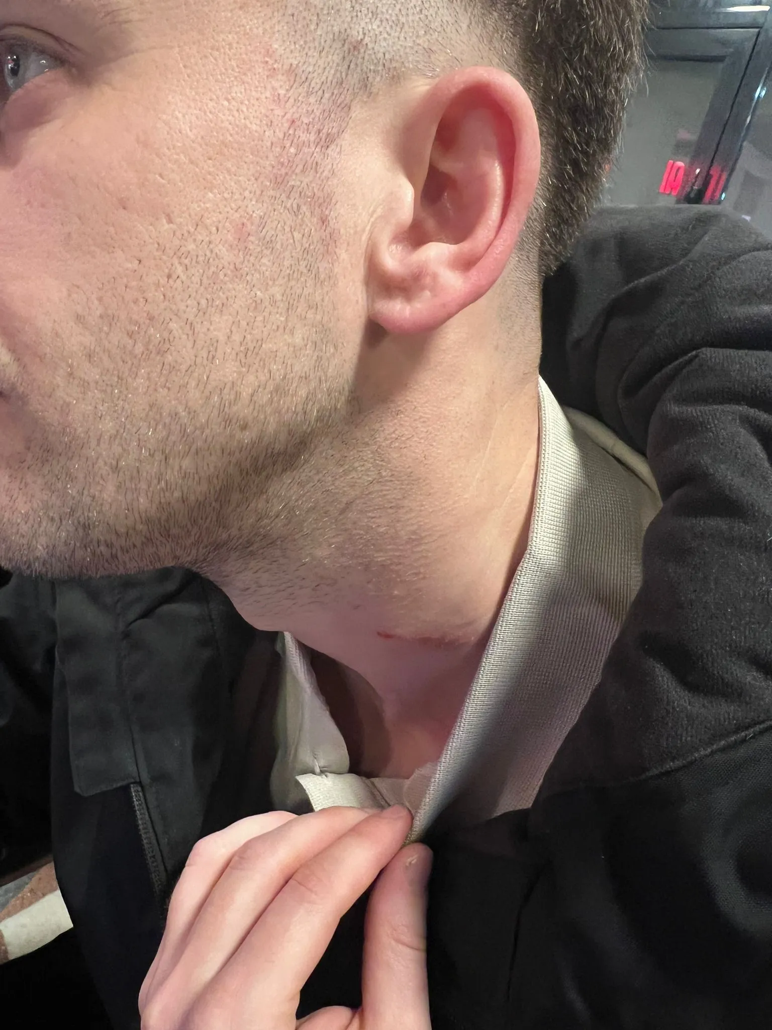 Bursa'da Maç Sonrası Ortalık Karıştı 2 Futbolcu Yaralı! (3)