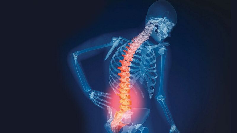 Omurga Kırıklarında Kullanılan Bu Yöntem Yaşam Kalitesini Artırıyor! (1)-1