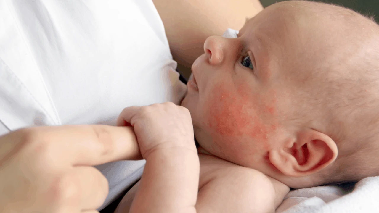 Genç Gazete Süt Alerjisi