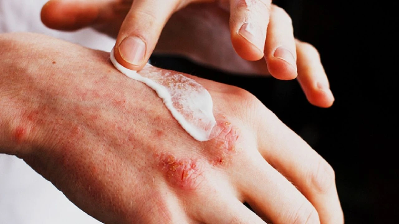 Genç Gazete Egzama 2