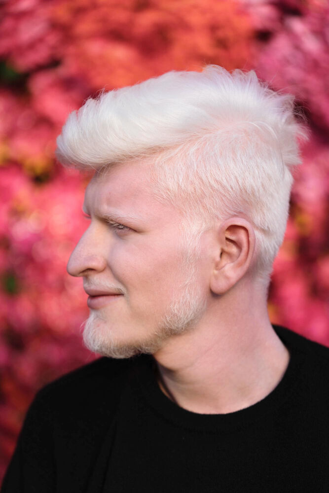 Saçlar Neden Beyazlar Beyaz Saç Beyazlasmis Sac Gencgazete (6)