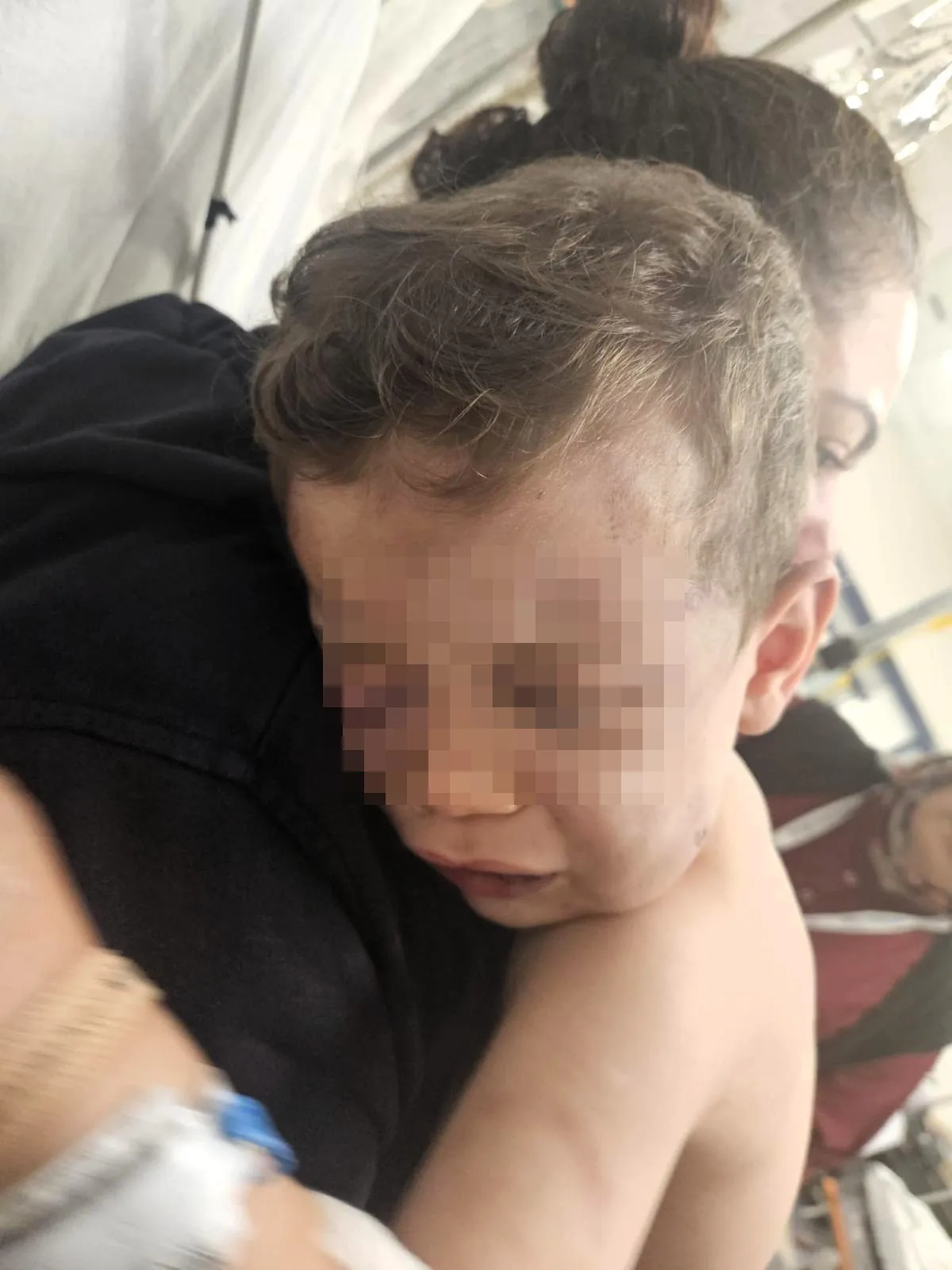 Annesinin Erkek Arkadaşı Tarafından Darp Edilen 2 Yaşındaki Bebek Yoğun Bakımda (1)