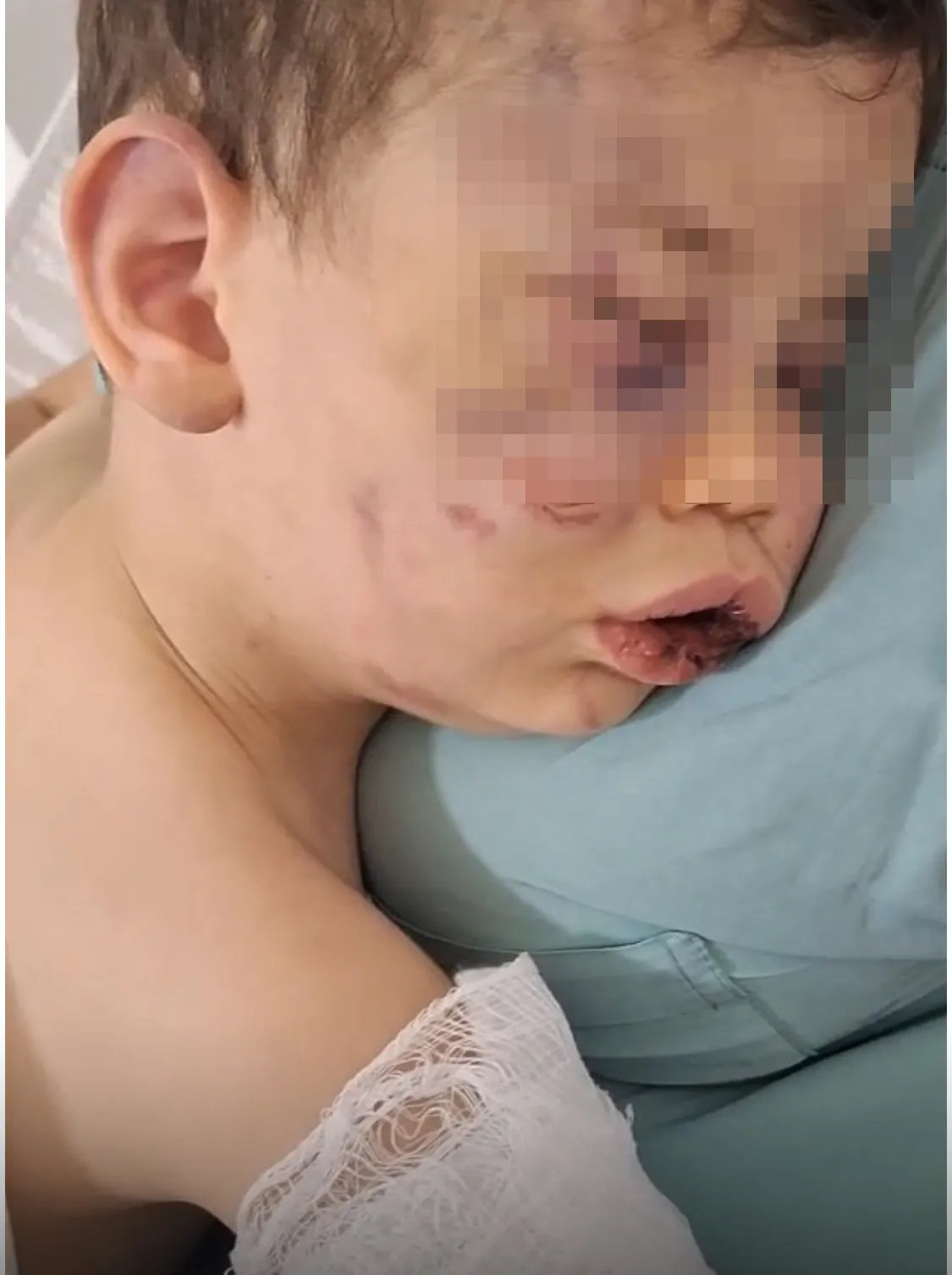 Annesinin Erkek Arkadaşı Tarafından Darp Edilen 2 Yaşındaki Bebek Yoğun Bakımda (3)