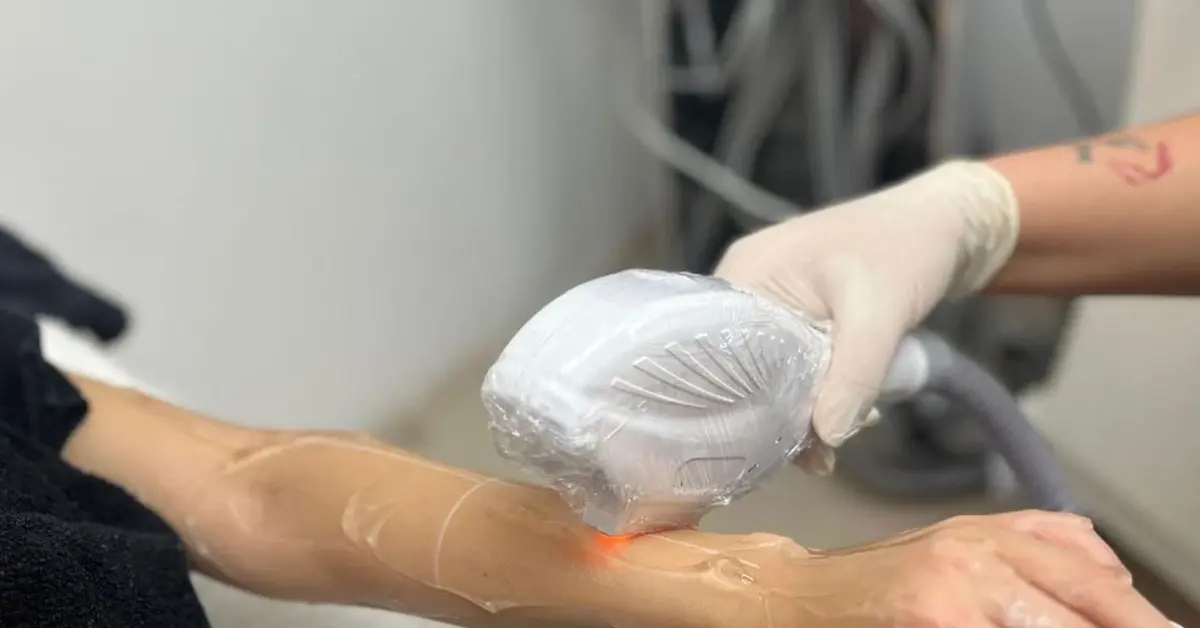 Genç Gazete Evde Yapılan Lazer Epilasyon Ile Profesyonel Merkezlerde Uygulanan Lazer Epilasyon Arasındaki Farklar Nelerdir 1
