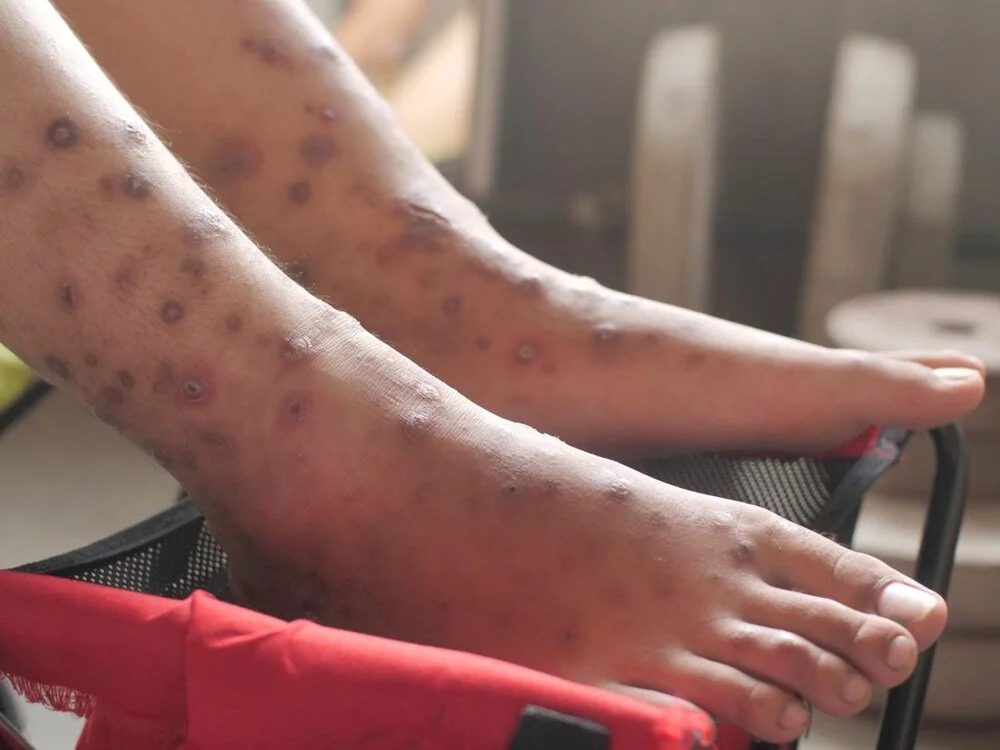 Syn5I3 Vvk0 Gz7 P S Veaer Ig