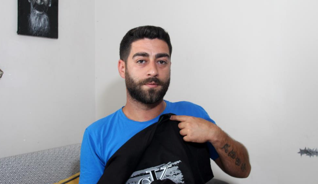 Bayramlaşmaya Gitti, Karnına Yorgun Mermi Isabet Etti (1)