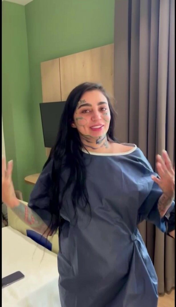 Brezilyalı Fenomenin İstanbul'da Geçirdiği Ameliyat Ölümle Sonuçlandı (3)