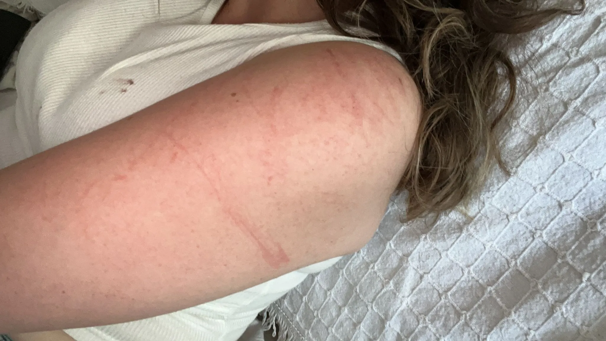 Bursa’da Akılalmaz Gasp! Kadının Bileziklerini Sahte Sanıp Almadı (8)