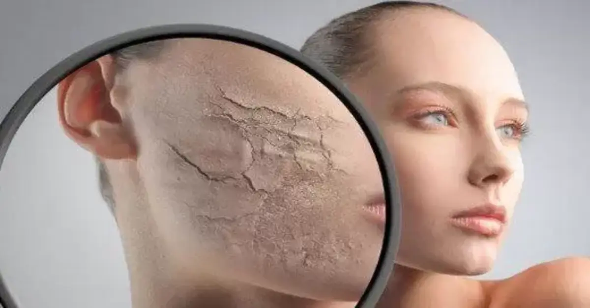Genç Gazete Cildinizdeki Kuruluk Sadece Havadan Mı Kaynaklanıyor, Yoksa Böbrek Hastalığının Habercisi Olabilir Mi 1