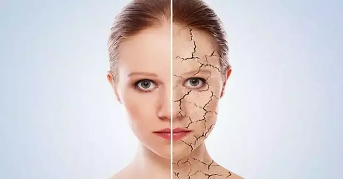 Genç Gazete Cildinizdeki Kuruluk Sadece Havadan Mı Kaynaklanıyor, Yoksa Böbrek Hastalığının Habercisi Olabilir Mi 2