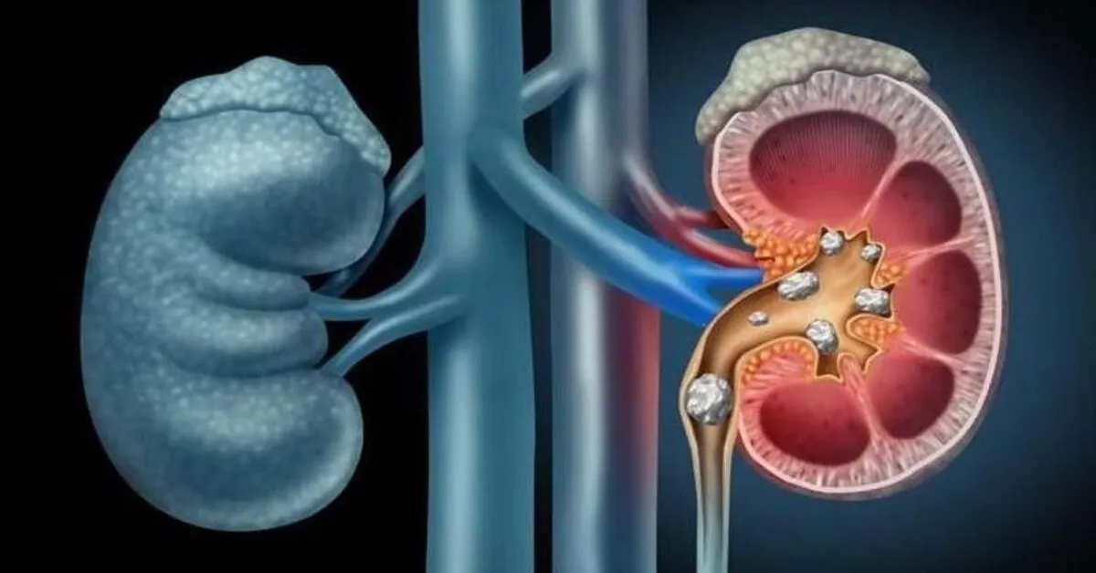 Genç Gazete Cildinizdeki Kuruluk Sadece Havadan Mı Kaynaklanıyor, Yoksa Böbrek Hastalığının Habercisi Olabilir Mi 3
