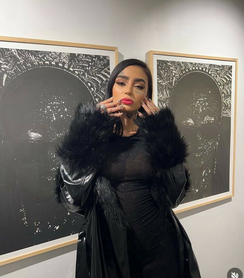 İl Sağlık Müdürlüğü Estetik Ameliyatında Ölen Fenomen Için Inceleme Başlattı (3)