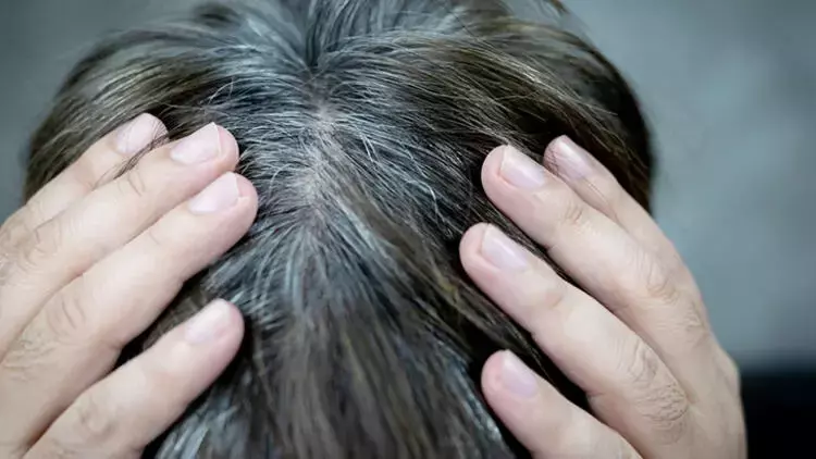 Saçınız Beyazlamaya Başladıysa Dikkat (1)